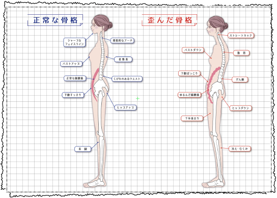 正常な骨格・歪んだ骨格